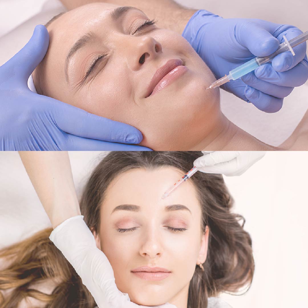 Bótox y ácido hialurónico